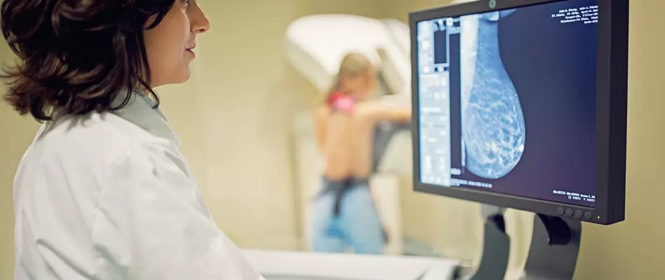 Comment la mammographie est-elle remboursée ?