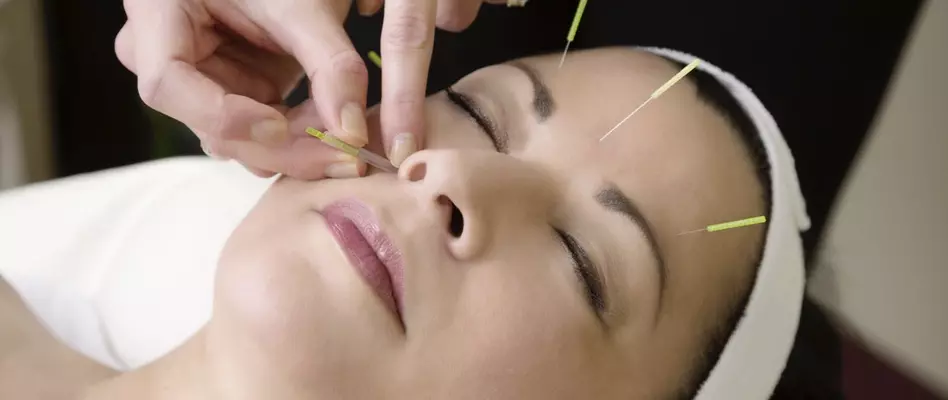 Connaissez-vous bien l’acupuncture, ses bienfaits et ses remboursements ?
