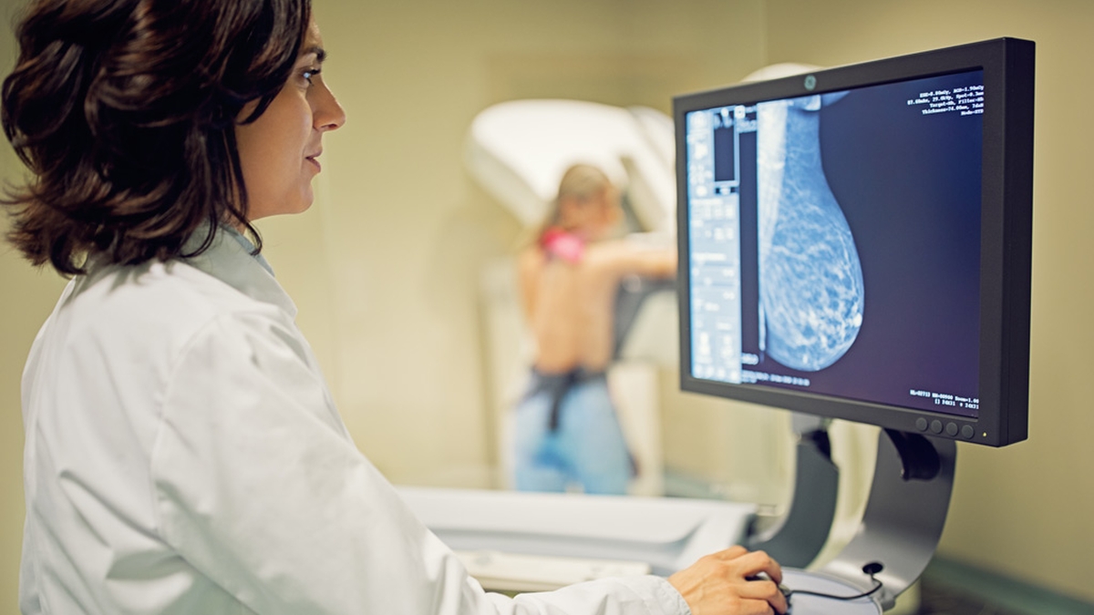 Comment la mammographie est-elle remboursée ?